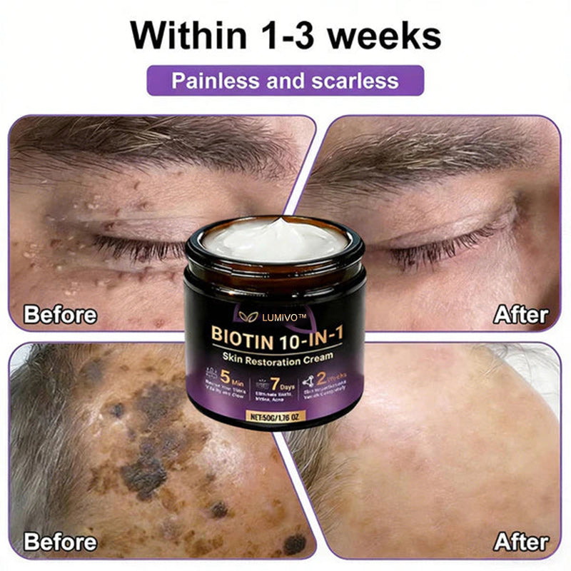 Ends Today: 80% OFF!✨LUMIVO® Biotin 10-in-1 Skin Restoration Cream 🍀Made and Shipped from USA
