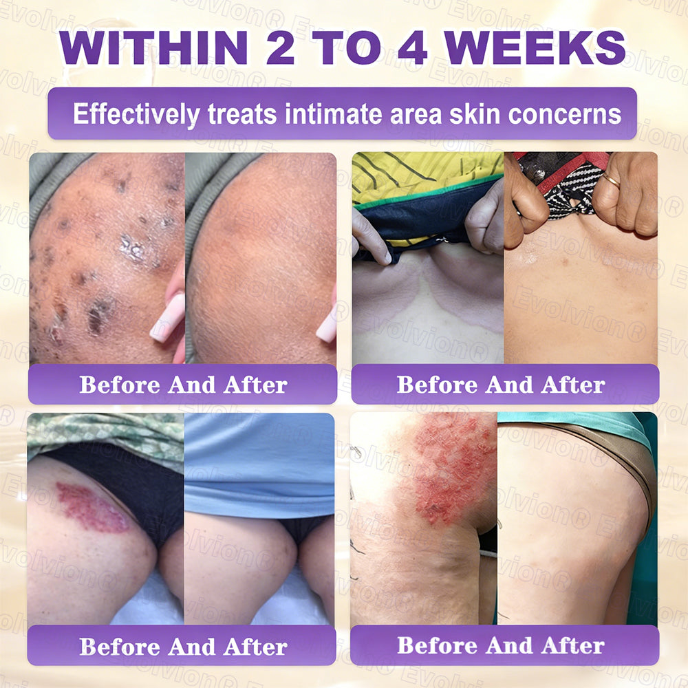 Ends Today: 80% OFF!✨LUMIVO® Biotin 10-in-1 Skin Restoration Cream 🍀Made and Shipped from USA
