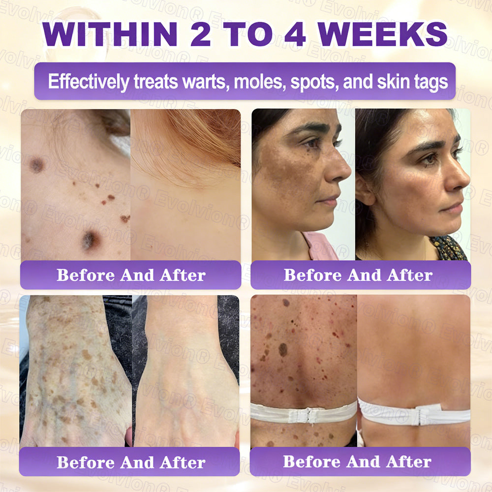Ends Today: 80% OFF!✨LUMIVO® Biotin 10-in-1 Skin Restoration Cream 🍀Made and Shipped from USA